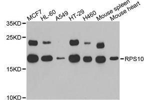 Western blot analysis of extracts of various cell lines, using RPS10 antibody. (RPS10 抗体)