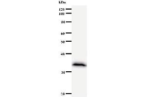 Western Blotting (WB) image for anti-Calcium And Integrin Binding Family Member 2 (CIB2) antibody (ABIN930952)