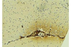 ABIN6279617 at 1/100 staining Mouse brain tissue by IHC-P. (DFNA5 抗体  (C-Term))