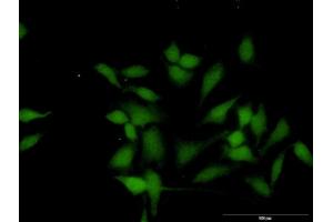 Immunofluorescence of purified MaxPab antibody to WTIP on HeLa cell. (WTIP 抗体  (AA 1-430))