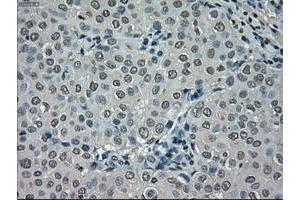 Image no. 2 for anti-NIMA (Never in Mitosis Gene A)-Related Kinase 6 (NEK6) antibody (ABIN1499686) (NEK6 抗体)