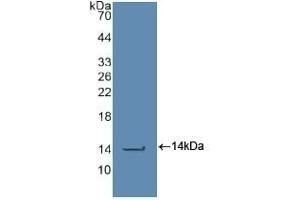 Detection of Recombinant CASP2, Human using Polyclonal Antibody to Caspase 2 (CASP2) (Caspase 2 抗体  (AA 334-452))