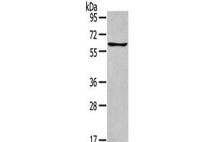 Western Blot analysis of Jurkat cells using GLP2R Polyclonal Antibody at dilution of 1:400 (GLP2R 抗体)