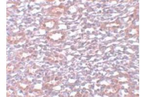 Immunohistochemical staining of rat kidney tissue with PIAS1 polyclonal antibody  at 5 ug/mL dilution. (PIAS1 抗体  (C-Term))