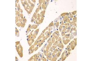 Immunohistochemistry of paraffin-embedded mouse heart using KYNU antibody. (KYNU 抗体  (AA 1-307))