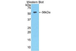 Western Blotting (WB) image for anti-Lipase, Hepatic (LIPC) (AA 103-356) antibody (ABIN1078291) (LIPC 抗体  (AA 103-356))