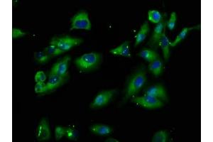Immunofluorescence staining of Hela cells with ABIN7163303 at 1:100, counter-stained with DAPI. (PIK3IP1 抗体  (AA 22-168))