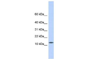 WB Suggested Anti-CDRT4 Antibody Titration: 0. (CDRT4 抗体  (Middle Region))