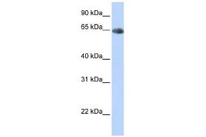 Western Blotting (WB) image for anti-Solute Carrier Family 6 (Neurotransmitter Transporter, Noradrenalin), Member 2 (SLC6A2) antibody (ABIN635638)