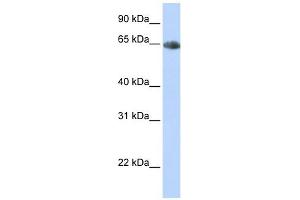 SLC6A2 antibody used at 1 ug/ml to detect target protein. (SLC6A2 抗体)