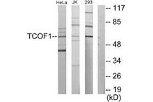 Western Blotting (WB) image for anti-Treacher Collins-Franceschetti Syndrome 1 (TCOF1) (AA 41-90) antibody (ABIN2879146) (TCOF1 抗体  (AA 41-90))