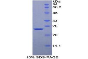 SDS-PAGE analysis of Mouse Cyclophilin D Protein. (PPID 蛋白)