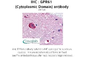 Image no. 1 for anti-G Protein-Coupled Receptor 61 (GPR61) (2nd Cytoplasmic Domain) antibody (ABIN1735131) (GPR61 抗体  (2nd Cytoplasmic Domain))