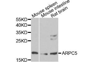 Western blot analysis of extracts of various cells, using ARPC5 antibody. (ARPC5 抗体)