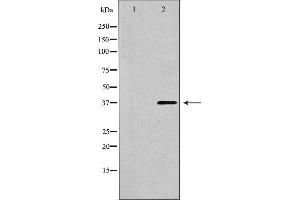 Western blot analysis of extracts of HeLa , using CTGF antibody. (CTGF 抗体  (Internal Region))