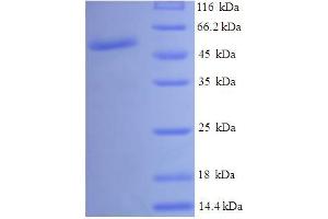 SDS-PAGE (SDS) image for UDP-Galactose-4-Epimerase (GALE) (AA 1-348), (full length) protein (His-SUMO Tag) (ABIN5711251)