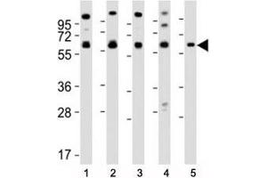 Western blot testing of Pyruvate Kinase antibody at 1:2000 dilution. (PKM2 抗体  (AA 121-151))