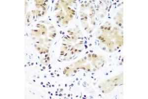 Immunohistochemistry of paraffin-embedded human stomach using AGO2 antibody (ABIN5973585) at dilution of 1/100 (40x lens). (AGO2 抗体)