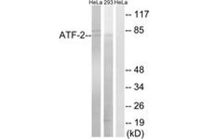 Western blot analysis of extracts from HeLa/293 cells, using ATF-2 (Ab-472) Antibody. (ATF2 抗体  (AA 441-490))