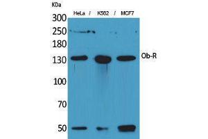 Western Blotting (WB) image for anti-Leptin Receptor (LEPR) (Internal Region) antibody (ABIN6285037) (Leptin Receptor 抗体  (Internal Region))
