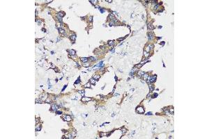 Immunohistochemistry (IHC) image for anti-Cyclin B1 (CCNB1) (C-Term) antibody (ABIN7266555)