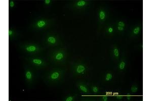 Immunofluorescence of monoclonal antibody to SMAD3 on HeLa cell. (SMAD3 抗体  (AA 1-110))