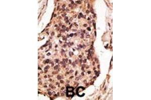 Immunohistochemistry (IHC) image for anti-Sialic Acid Binding Ig-Like Lectin 8 (SIGLEC8) antibody (ABIN2998632) (SIGLEC8 抗体)