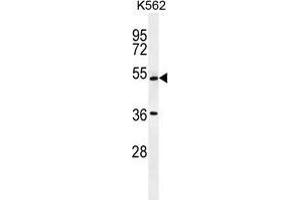 UAP1L1 Antibody (N-term) western blot analysis in K562 cell line lysates (35 µg/lane). (UAP1L1 抗体  (N-Term))