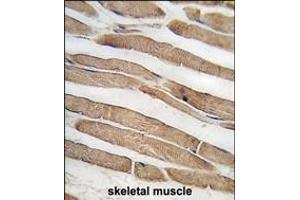 Formalin-fixed and paraffin-embedded human skeletal muscle tissue reacted with ITGB1BP3 antibody (N-term) (ABIN389290 and ABIN2839411) , which was peroxidase-conjugated to the secondary antibody, followed by DAB staining. (ITGB1BP3 抗体  (N-Term))