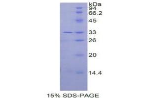 SDS-PAGE analysis of Human IL31RA Protein. (IL31RA 蛋白)