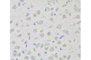 Immunohistochemistry of paraffin-embedded Mouse brain using PENK Polyclonal Antibody at dilution of 1:100 (40x lens). (Enkephalin 抗体)