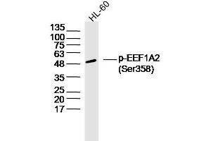 HL60 lysates probed with EEF1A2 (Ser358) Polyclonal Antibody, Unconjugated  at 1:300 dilution and 4˚C overnight incubation. (EEF1A2 抗体  (pSer358))