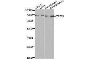 Western blot analysis of extracts of various cell lines, using ZAP70 Antibody. (ZAP70 抗体  (AA 1-300))