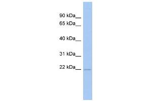 WB Suggested Anti-RWDD4A Antibody Titration: 0. (RWDD4A 抗体  (N-Term))