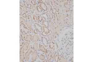 Immunohistochemical analysis of B on paraffin-embedded Human kidney tissue was performed on the Leica®BOND RXm. (SPHK2 抗体  (C-Term))