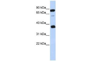 BCAP29 antibody used at 1 ug/ml to detect target protein. (BCAP29 抗体  (Middle Region))