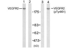 Western blot analysis of extracts from SK-OV3 cells using VEGFR2 (Ab-951) antibody (E021079, Line 1 and 2) and VEGFR2 (phospho-Tyr951) antibody (E011086, Line 3 and 4). (VEGFR2/CD309 抗体  (pTyr951))