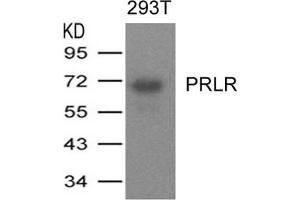 Western blot analysis of extracts from 293T cells expressing human PRLR protein using PRLR Antibody. (Prolactin Receptor 抗体)