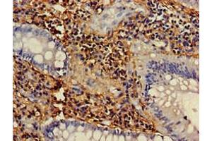 Immunohistochemistry (IHC) image for anti-Neutrophil Cytosol Factor 1 (NCF1) (AA 63-232) antibody (ABIN7161494)