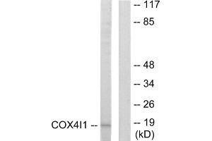 Western blot analysis of extracts from A549 cells, using COX41 antibody. (COX IV 抗体  (N-Term))