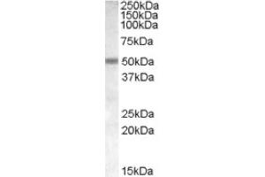 Image no. 1 for anti-Cholinergic Receptor, Nicotinic, beta 3 (Neuronal) (CHRNB3) (Internal Region) antibody (ABIN374999) (CHRNB3 抗体  (Internal Region))