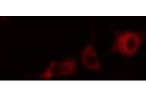 Immunofluorescence (fixed cells) (IF/ICC) image for anti-Cytochrome P450, Family 2, Subfamily J, Polypeptide 2 (CYP2J2) (Internal Region) antibody (ABIN6261201)
