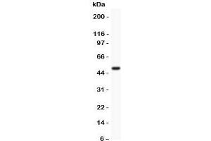 Western blot testing of MCAK antibody and recombinant human protein (0. (KIF2C 抗体  (AA 531-725))