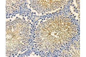 ABIN7094986 and ABIN7099042 at 1/100 staining rat testis tissue by IHC-P. (ARHGAP44 抗体)