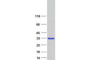 Western Blotting (WB) image for Aspartate Dehydrogenase Domain Containing (ASPDH) (Transcript Variant 1) protein (Myc-DYKDDDDK Tag) (ABIN2714996)