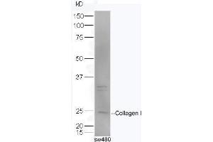 SW480 lysates probed with Rabbit Anti-Pro-Collagen I Polyclonal Antibody, Unconjugated  at 1:5000 for 90 min at 37˚C. (Collagen Type I 抗体  (AA 1321-1400))
