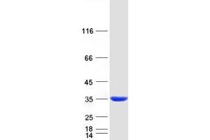 Western Blotting (WB) image for Phenazine Biosynthesis-Like Protein Domain Containing 1 (PBLD1) (Transcript Variant 1) protein (Myc-DYKDDDDK Tag) (ABIN2725567)