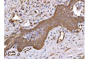IHC analysis of ch TOG/CKAP5 using anti-ch TOG/CKAP5 antibody (ABIN6719294).