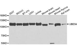 Western blot analysis of extract of various cells, using UBE3A antibody. (ube3a 抗体)