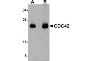 Western Blotting (WB) image for anti-Cell Division Cycle 42 (GTP Binding Protein, 25kDa) (CDC42) (N-Term) antibody (ABIN1031310) (CDC42 抗体  (N-Term))